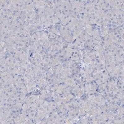 Immunohistochemistry-Paraffin: ATP4A Antibody [NBP1-88889]