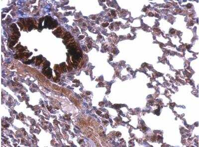 Immunohistochemistry-Paraffin: ATP5A Antibody [NBP2-15512]