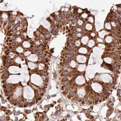 Immunohistochemistry-Paraffin: ATP5A Antibody [NBP2-38470]