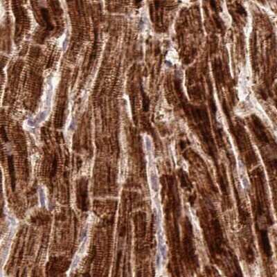 Immunohistochemistry-Paraffin: ATP5A Antibody [NBP2-38470]