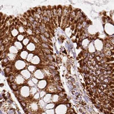 Immunohistochemistry-Paraffin: ATP5A Antibody [NBP2-38525]