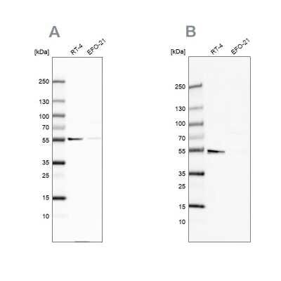 Western Blot: ATP5A Antibody [NBP2-38525]