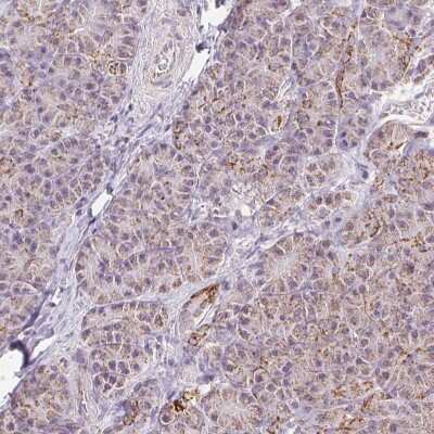 Immunohistochemistry-Paraffin: ATP5F1 Antibody [NBP2-49255]