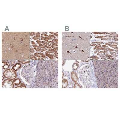Immunohistochemistry-Paraffin: ATP5F1 Antibody [NBP2-49255]