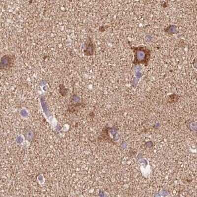 Immunohistochemistry-Paraffin: ATP5F1 Antibody [NBP2-49255]