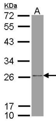 Western Blot: ATP5F1 Antibody [NBP1-33465]