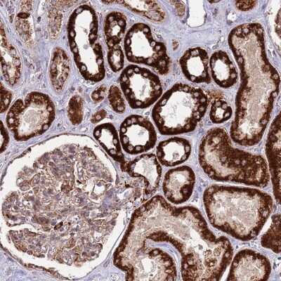 Immunohistochemistry: ATP5H Antibody [NBP2-48906]