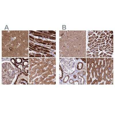 Immunohistochemistry-Paraffin: ATP5H Antibody [NBP2-48906]