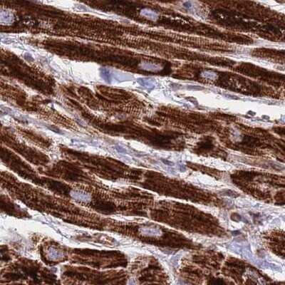 Immunohistochemistry-Paraffin: ATP5H Antibody [NBP2-48906]