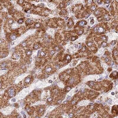 Immunohistochemistry-Paraffin: ATP5H Antibody [NBP2-48906]