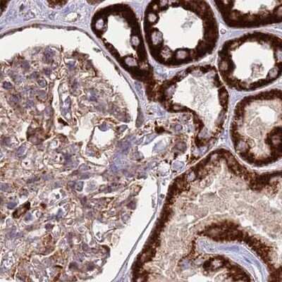 Immunohistochemistry-Paraffin: ATP5H Antibody [NBP2-48906]