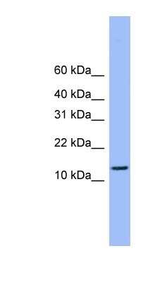 Western Blot: ATP5H Antibody [NBP1-79479]