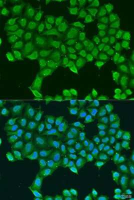 Immunocytochemistry/ Immunofluorescence: ATP5O Antibody - BSA Free [NBP2-92921]