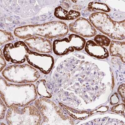 Immunohistochemistry-Paraffin: ATP5O Antibody [NBP2-32602]