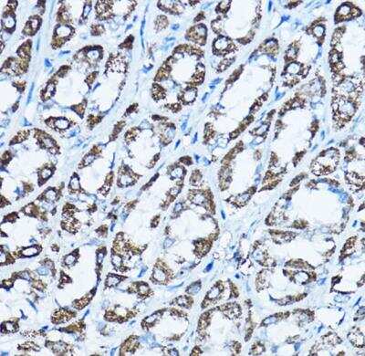 Immunohistochemistry-Paraffin: ATP5O Antibody - BSA Free [NBP2-92921]