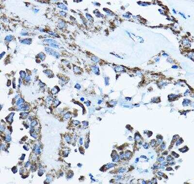 Immunohistochemistry-Paraffin: ATP5O Antibody - BSA Free [NBP2-92921]