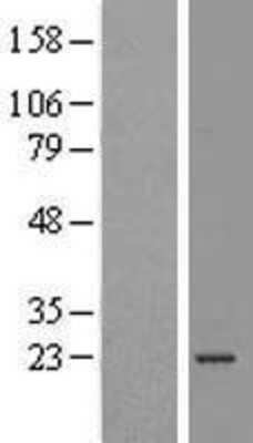 Western Blot: ATP5O Overexpression Lysate [NBL1-07829]