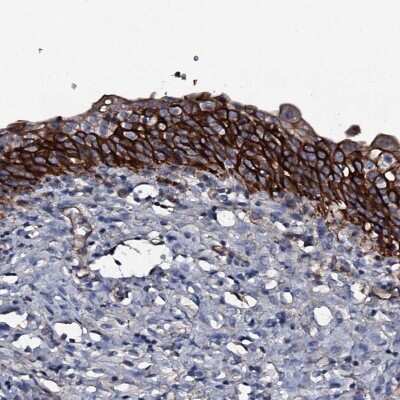 Immunohistochemistry-Paraffin: ATP5SL Antibody [NBP2-14509]
