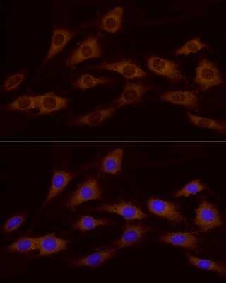 Immunocytochemistry/ Immunofluorescence: ATP6V0A1 Antibody - Azide and BSA Free [NBP2-92219]