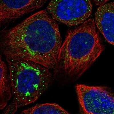 Immunocytochemistry/ Immunofluorescence: ATP6V0A1 Antibody [NBP1-89342]