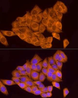Immunocytochemistry/ Immunofluorescence: ATP6V0A1 Antibody - Azide and BSA Free [NBP2-92219]