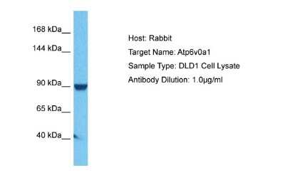 Western Blot: ATP6V0A1 Antibody [NBP2-87054]