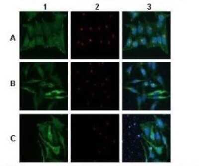Immunohistochemistry: ATP6V0A2 Antibody [NBP1-59069]
