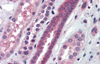 Immunohistochemistry: ATP6V0A2 Antibody [NBP1-59069]