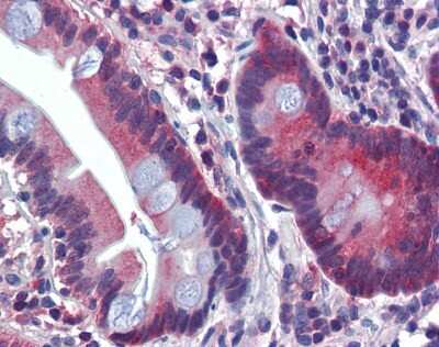 Immunohistochemistry-Paraffin: ATP6V0A2 Antibody [NBP1-59069]