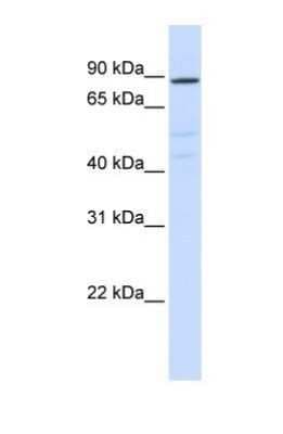 Western Blot: ATP6V0A2 Antibody [NBP1-59069]