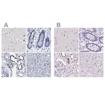 Immunohistochemistry-Paraffin: ATP6V0A4 Antibody [NBP1-89330]