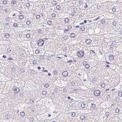 Immunohistochemistry-Paraffin: ATP6V0A4 Antibody [NBP2-39030]