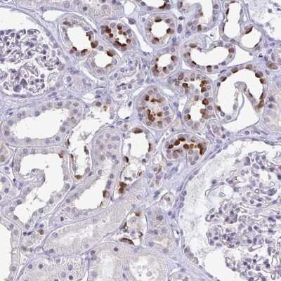 Immunohistochemistry-Paraffin: ATP6V0D2 Antibody [NBP2-31600]