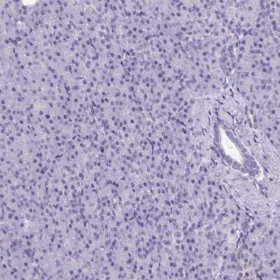Immunohistochemistry-Paraffin: ATP6V0D2 Antibody [NBP2-31600]
