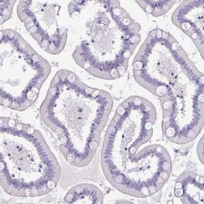 Immunohistochemistry-Paraffin: ATP6V0D2 Antibody [NBP2-31600]