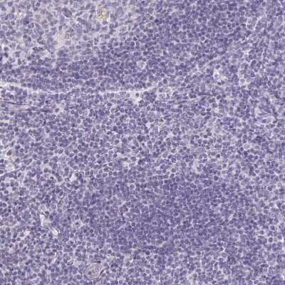 Immunohistochemistry-Paraffin: ATP6V0D2 Antibody [NBP2-31600]