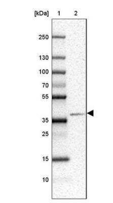 Western Blot: ATP6V0D2 Antibody [NBP2-31600]
