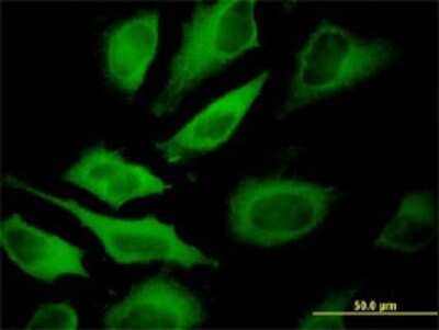Immunocytochemistry/ Immunofluorescence: ATP6V1A Antibody (4F5) [H00000523-M02]
