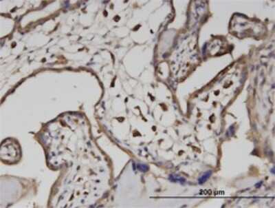 Immunohistochemistry-Paraffin: ATP6V1A Antibody (4F5) [H00000523-M02]