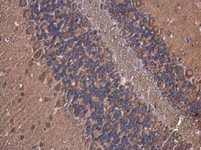 Immunohistochemistry-Paraffin: ATP6V1A Antibody (GT3846) [NBP3-13540]