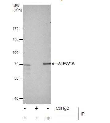 Immunoprecipitation: ATP6V1A Antibody [NBP1-33021]