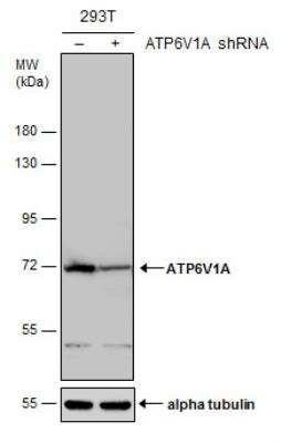 Knockout Validated: ATP6V1A Antibody [NBP1-33021]