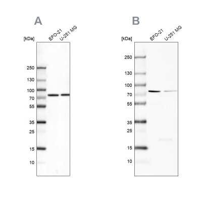 Western Blot: ATP6V1A Antibody [NBP2-55148]