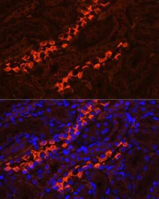 Immunohistochemistry: ATP6V1B1 Antibody - BSA Free [NBP2-92479]