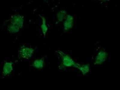 Immunocytochemistry/ Immunofluorescence: ATP6V1B1 Antibody (OTI1H6) - Azide and BSA Free [NBP2-70237]