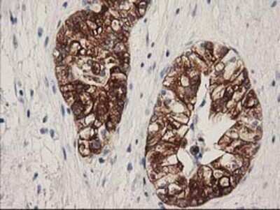 Immunohistochemistry: ATP6V1B1 Antibody (OTI1H6) - Azide and BSA Free [NBP2-70237]