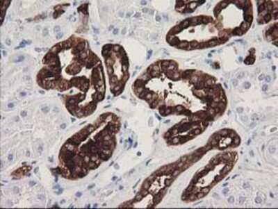 Immunohistochemistry: ATP6V1B1 Antibody (OTI1H6) - Azide and BSA Free [NBP2-70237]
