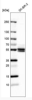 Western Blot: ATP6V1B1 Antibody [NBP2-33962]