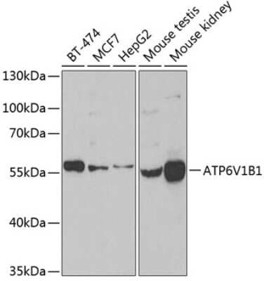 Western Blot: ATP6V1B1 AntibodyBSA Free [NBP2-92479]