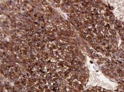 Immunohistochemistry: ATP6V1B2 Antibody (OTI1E11) [NBP2-45525]